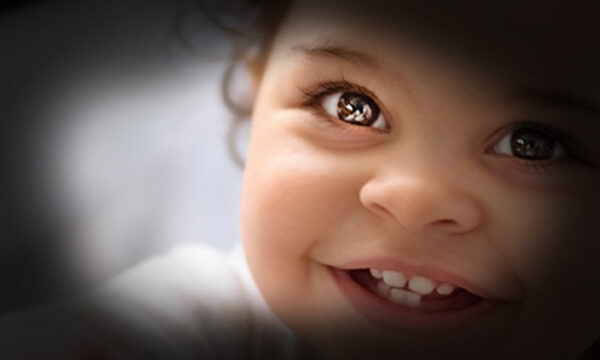 A simulation of how a baby's face may appear to a person with glaucoma.